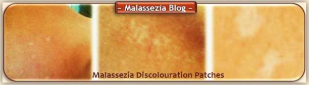 Discolouration Patches1 MB