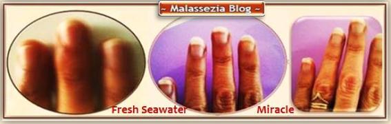 Malassezia - Seawater1 MB