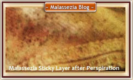 Malassezia  Sticky Layer-Perspiration1 MB