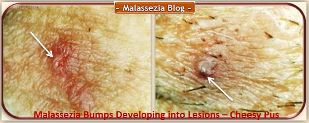 Bumps and Lesions1 MB