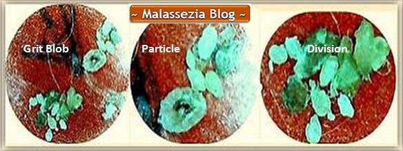 Malasezia grit particle division 1MB