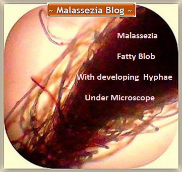 Malassezia  Blob under Microscope1 MB
