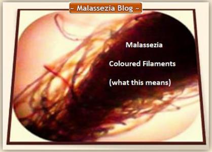 Malassezia  Coloured Filaments1 MB