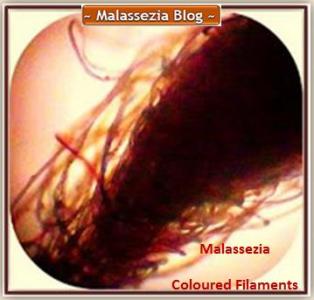 Malassezia  Coloured Filaments3 MB
