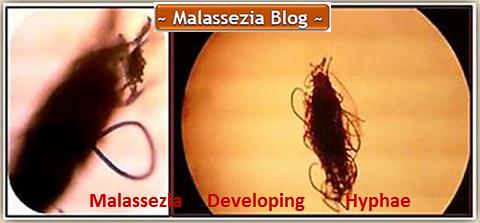 Malassezia developing Hyphae1 MB