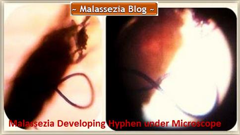 Malassezia developing Hyphae2MB
