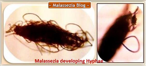 Malassezia developing Hyphae3 MB