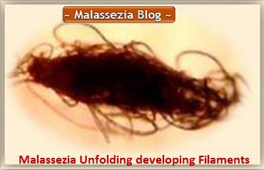 Malassezia developing Hyphae4 MB