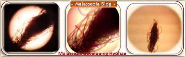 Malassezia developing Hyphae5 MB