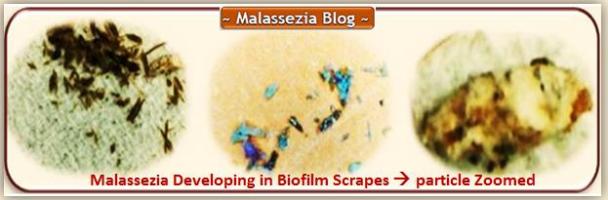 Malassezia  Developing in Scrapes1 MB