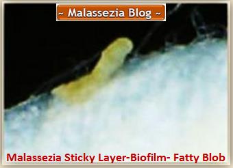 Malassezia Fatty Blob1 MB