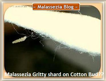 Malassezia Gitty shard1 MB jpg