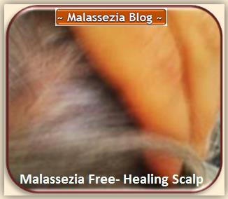 Malassezia Healing Scalp1 MB
