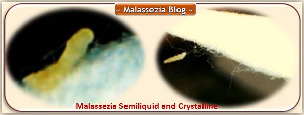 Malassezia Liquid and Crystalline1 MB