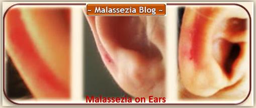 Malassezia on Ears1 MB