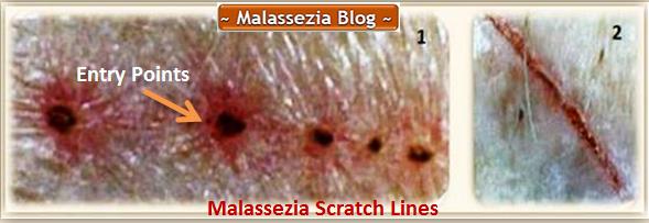 Malassezia  Scratch Lines 1 MB