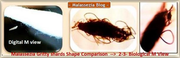 Malassezia shards Shape Comparison1 MB