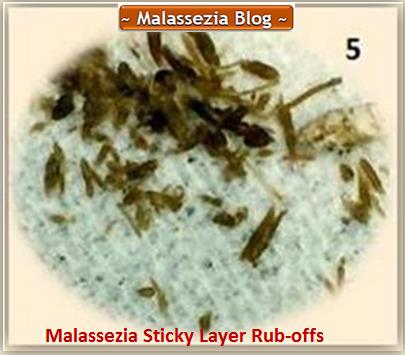 Malassezia  Sticky Layer rub-offs1 MB