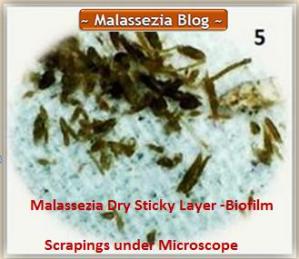 Malassezia  Sticky Layer Scrapings1 MB