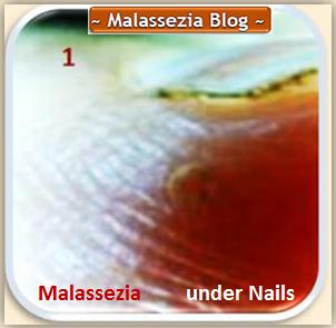 Malassezia Under Nails2 MB